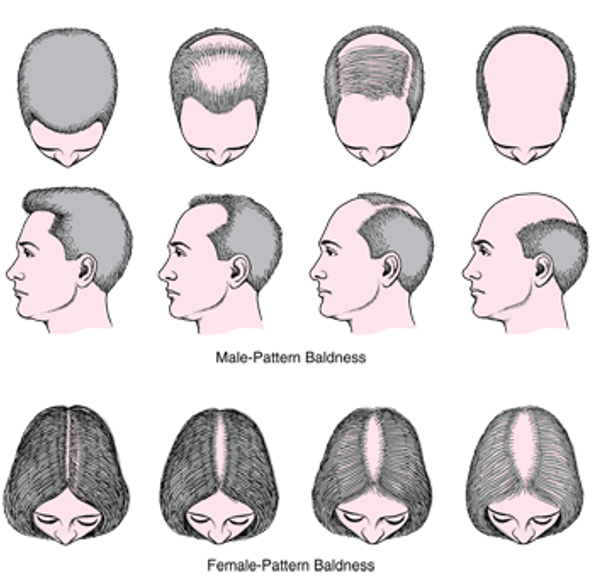 Causes of Hair Loss -Main Points